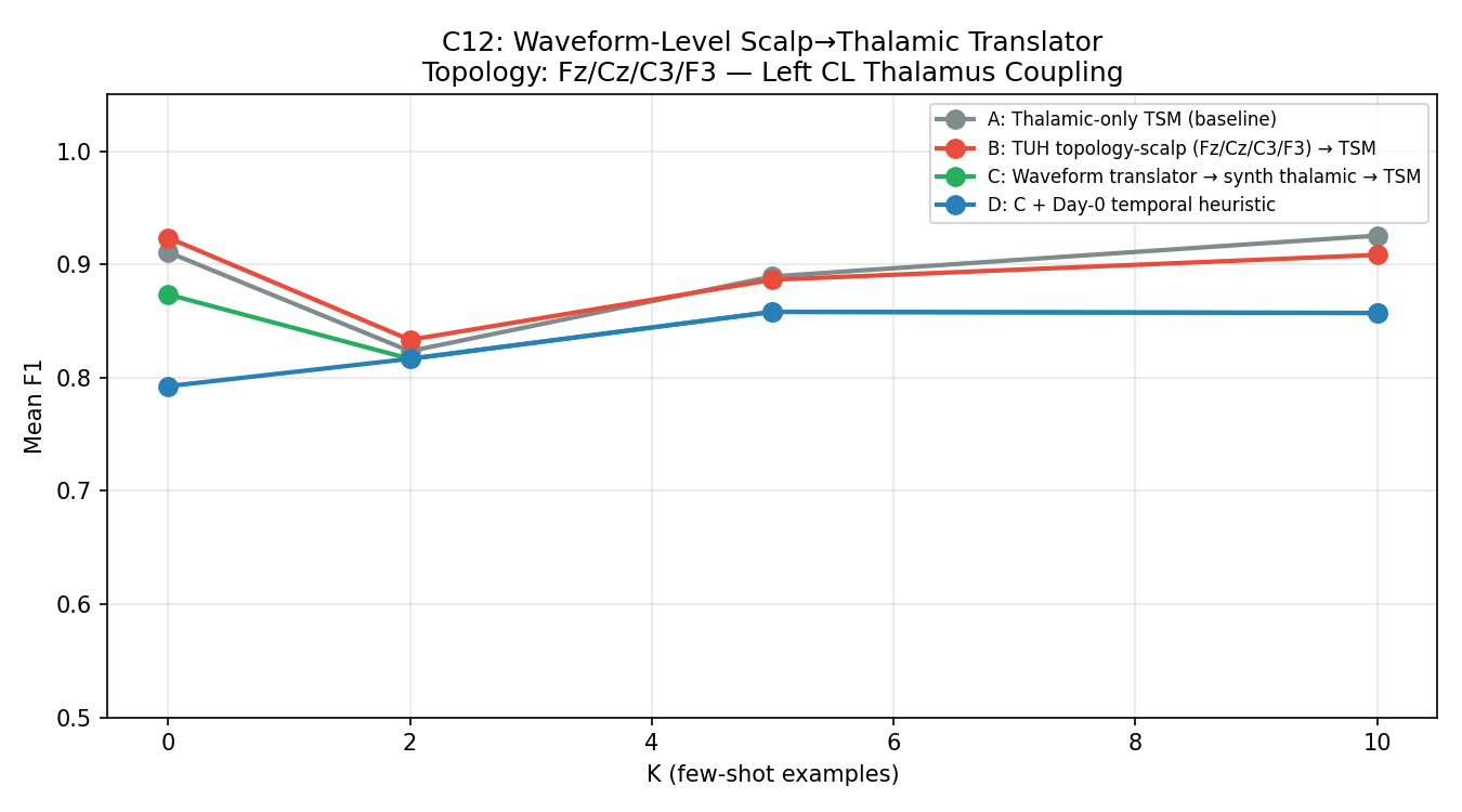 CycleGAN waveform translator